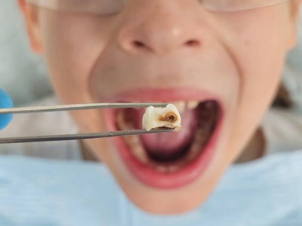 Best Pediatric Emergency Dentist in Morn, GA